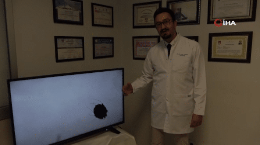 Muğla Eğitim ve Araştırma Hastanesi Dermatoloji Uzmanı Doç. Dr. Aslan Yürekli, uyuz hastalığının pandemi sonrasında yüzde 50 oranla arttığını söyledi.